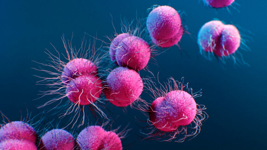 خلية السيلان أو الجونوريا